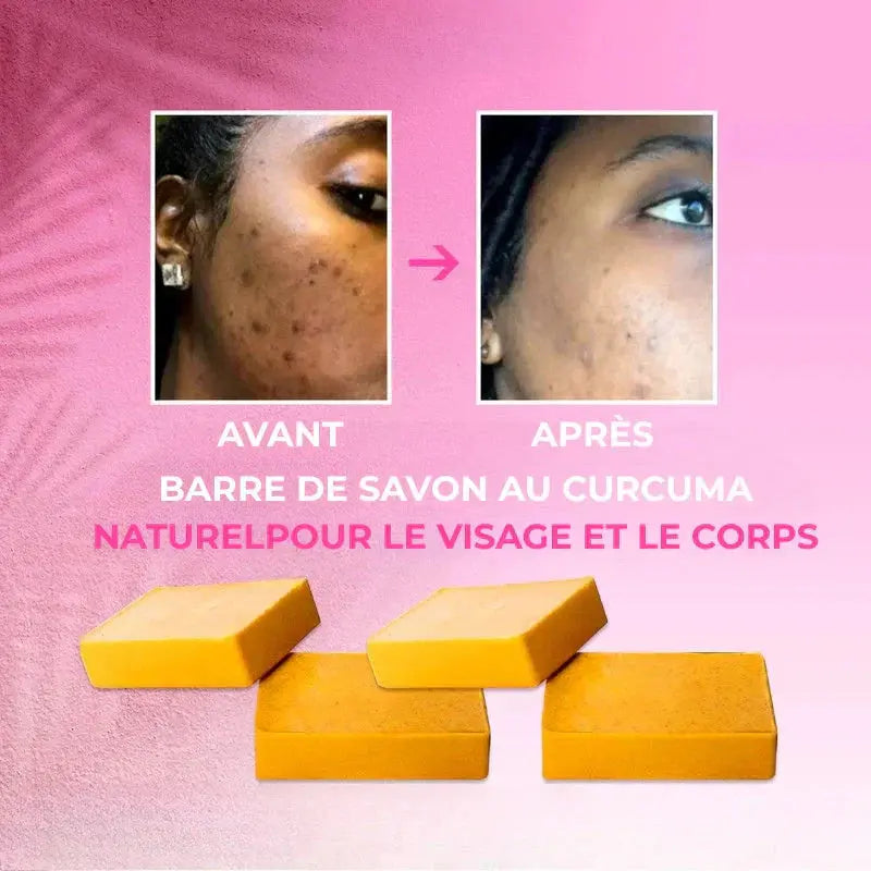 Savon Éclaircissant Naturel au Curcuma et Koji Acid - Luxlift